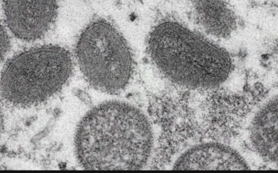Monkeypox